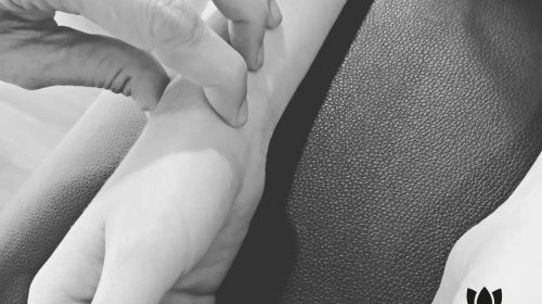 consulta de acupuntura en madrid 2